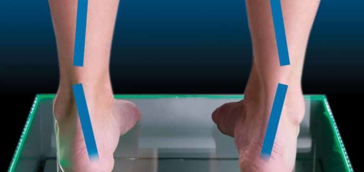 The Best Women’s Shoes for Supination