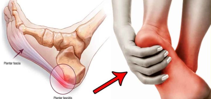 saucony guide 10 plantar fasciitis