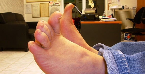 best boots for drop foot